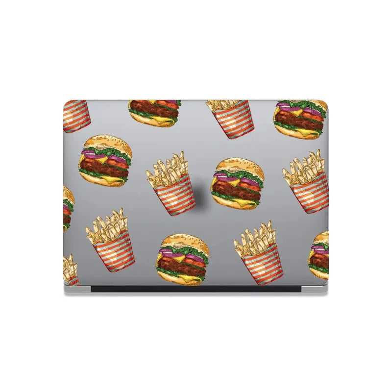 This is us design series Hamburger Fries Macbook case
